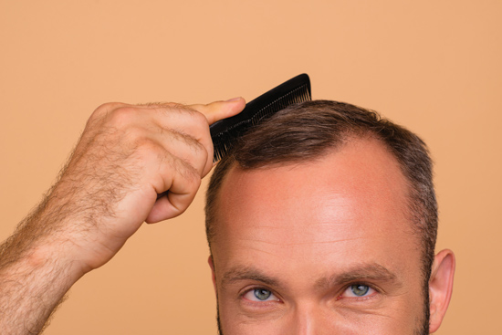 35 Stylish Hairstyles For Balding Men in 2024 | Balding mens hairstyles, Mens  haircuts short, Long hair styles men